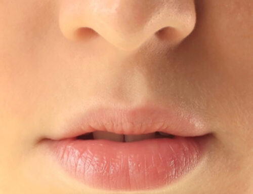 Consejos para lucir unos labios hermosos – Dra. Lina Vanegas