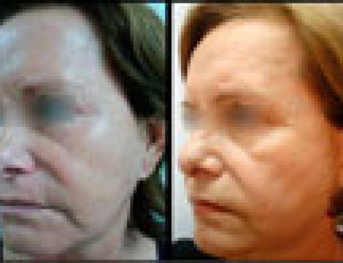 Consejos para demorar el envejecimiento – Dra. Angélica Dominguez