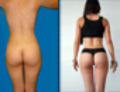 Tips para tener la cola de tus sueños – Dr. Alejandro Chiappe